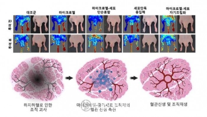 마이크로젤-세포 자기조립화 줄기세포치료제의 효능.jpg